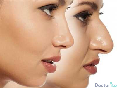 بهترین جراح بینی در تبریز