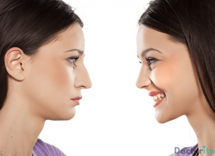 بهترین جراح بینی در تبریز