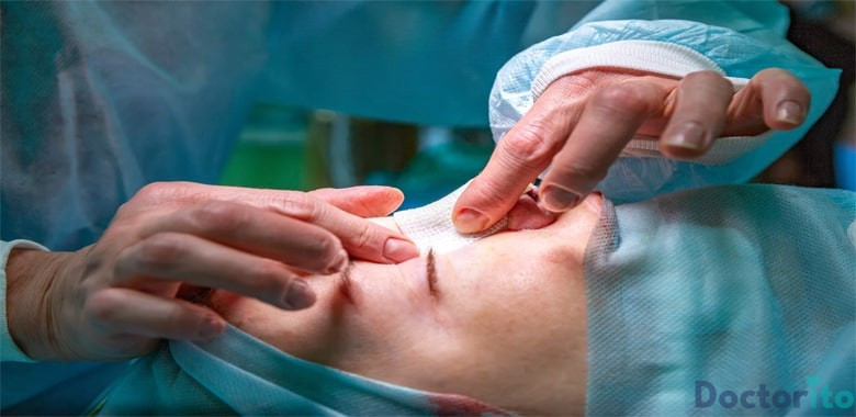 معروف ترین جراح بینی گوشتی در تبریز