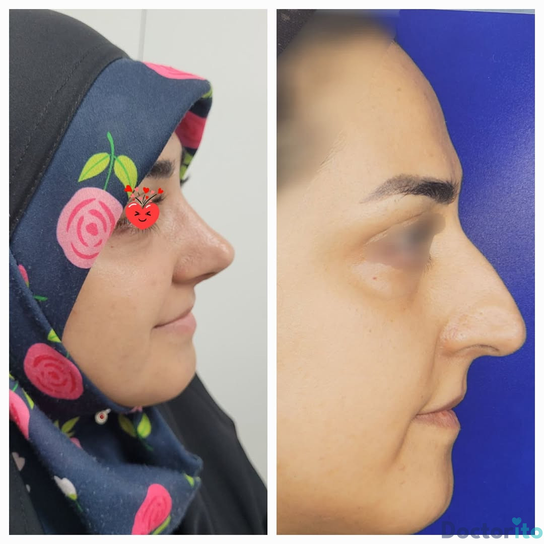نمونه کار دکتر شمیلا رضوانی نیا (5)