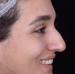نمونه کار دکتر حامد پوستچی