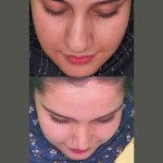 نمونه عمل بینی دکتر محسن فانی