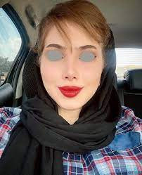 نمونه عمل دکتر شهاب خسروی بروجنی