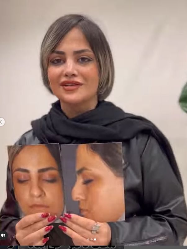 نمونه کار دکتر پیام حق پناه2