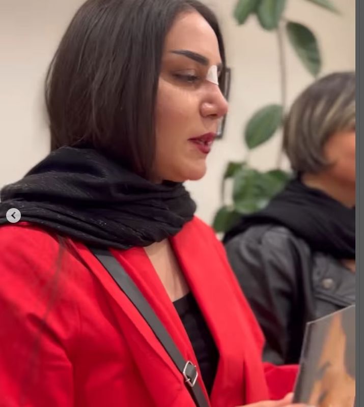 نمونه کار دکتر پیام حق پناه