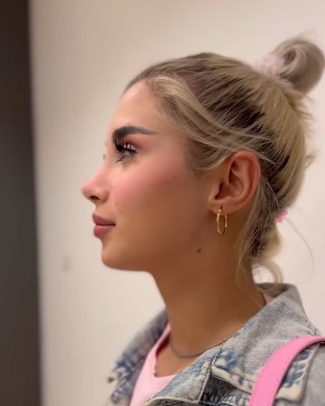 نمونه کار دکتر پیام حق پناه