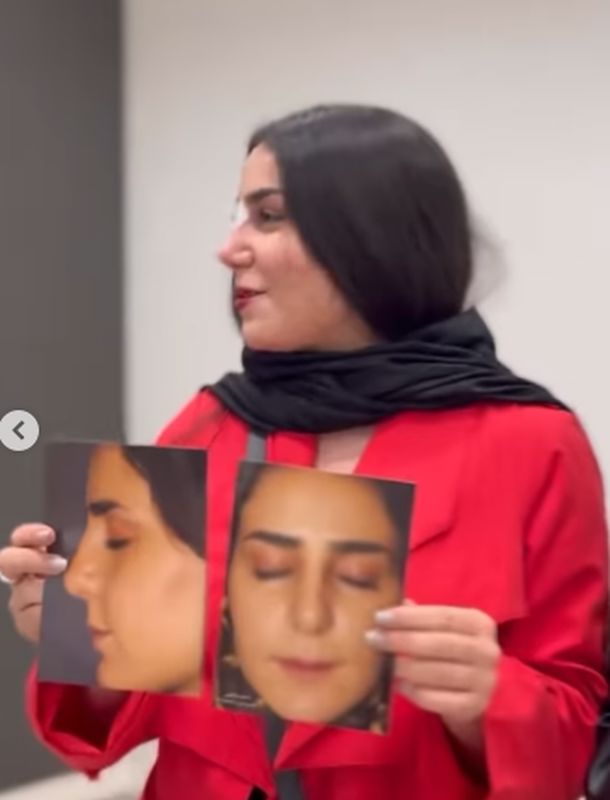 نمونه کار دکتر پیام حق پناه4