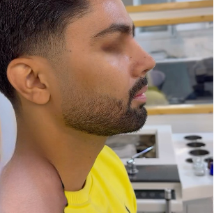 نمونه کار دکتر حامد پوستچی