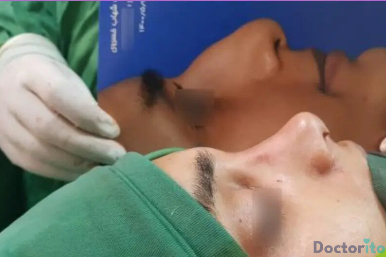 نمونه عمل بینی دکتر شهاب خسروی (1)