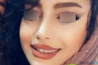 نمونه عمل بینی دکتر شهاب خسروی (2)