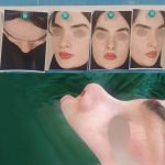 نمونه عمل بینی دکتر حامد هاتفی 3