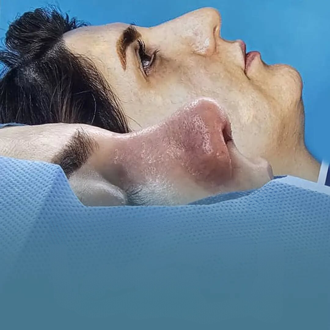 نمونه عمل بینی دکتر حمیدرضا فرجاد