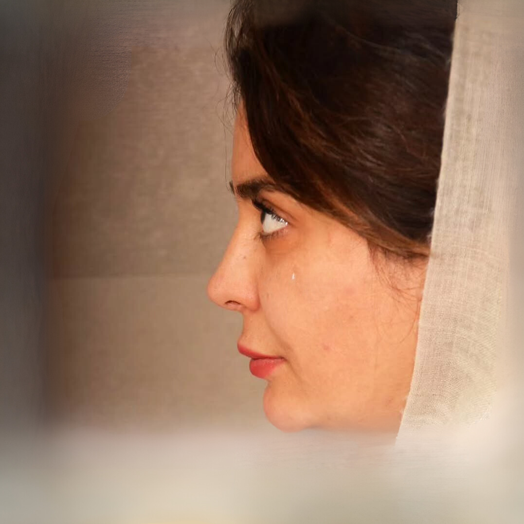 دکتر مجید راستی اردکانی نمونه عمل 5