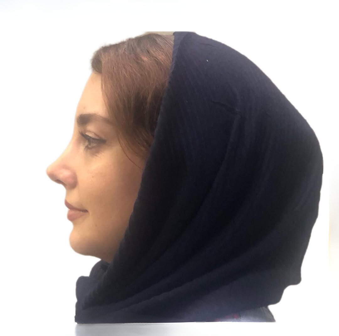 نمونه عمل بینی دکتر راستی