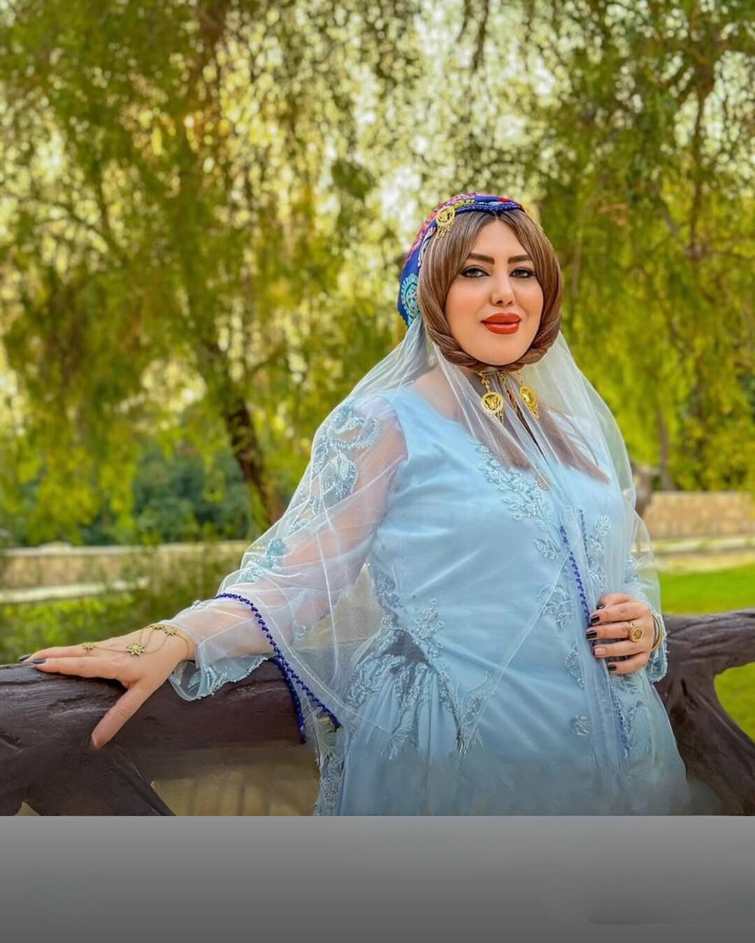 نمونه عمل بینی دکتر سعید مرزبان