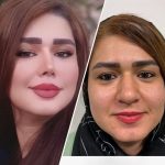 نمونه عمل بینی دکتر مجتبی میبدیان