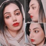 نمونه عمل بینی دکتر مجتبی میبدیان 2