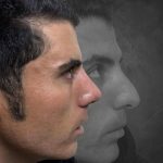 نمونه عمل بینی دکتر محمدحسین دادگرنیا 4