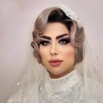 نمونه عمل بینی دکتر محمدعلی آقایی (1)