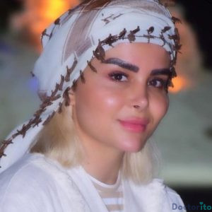 نمونه عمل بینی دکتر امیرعلی میرفخرایی 5