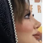 نمونه عمل بینی دکتر امید قاسم زاده 4