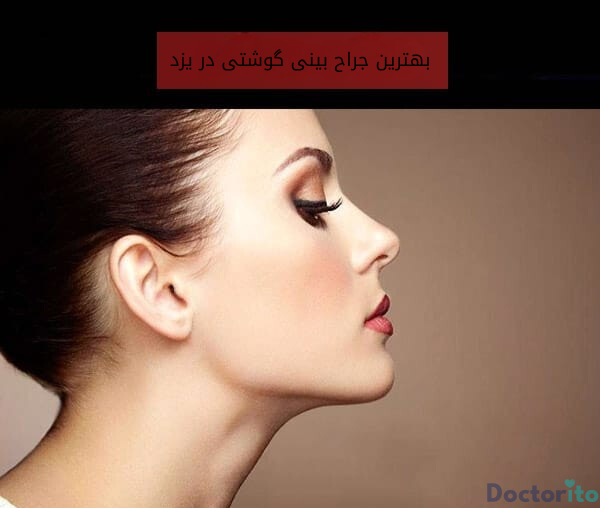 بهترین جراح بینی گوشتی در یزد