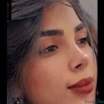 نمونه جراحی بینی دکتر امید قاسم زاده (2)