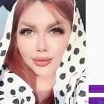 نمونه جراحی بینی دکتر حسین ختمی (2)