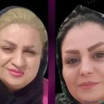 نمونه جراحی بینی دکتر حسین ختمی (3)