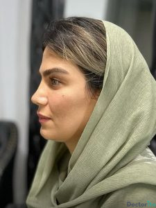 نمونه عمل بینی دکتر امیر دریانی 6
