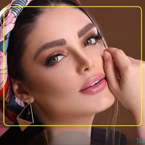 نمونه عمل بینی دکتر اکبر اعتمادی 3