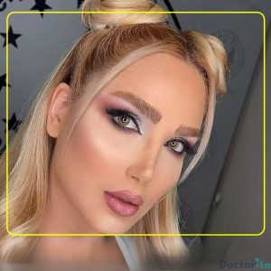 نمونه عمل بینی دکتر اکبر اعتمادی 6
