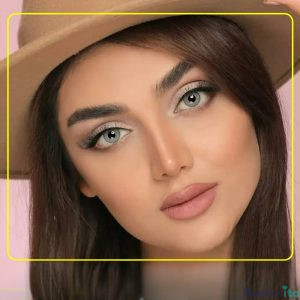 نمونه عمل بینی دکتر اکبر اعتمادی 4