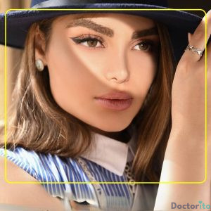 نمونه عمل بینی دکتر اکبر اعتمادی 2