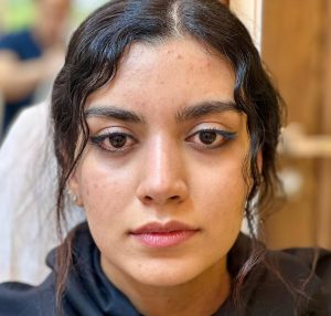 نمونه عمل بینی دکتر حمیدرضا نوری (2)