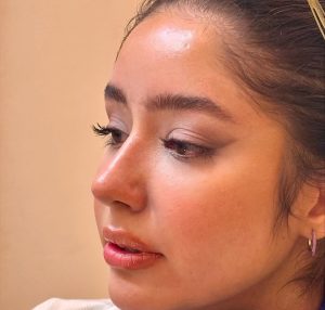 نمونه عمل بینی دکتر حمیدرضا نوری (5)