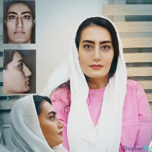 نمونه عمل بینی دکتر حمیدرضا راستی 6