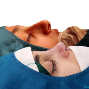 نمونه عمل بینی دکتر حمیدرضا راستی 2