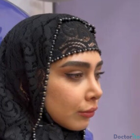 نمونه عمل بینی دکتر رضا کریمیان (1)