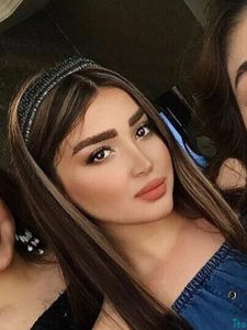 نمونه عمل بینی دکتر شبنم حاج علیپور (1)