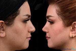 نمونه عمل بینی دکتر علی جاودانی (1)