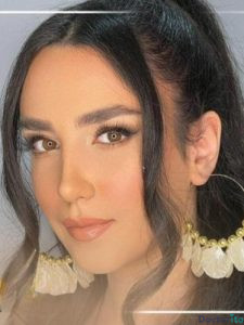 نمونه عمل بینی دکتر علیرضا محبی (2)