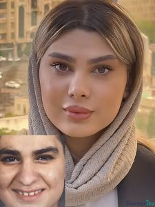 نمونه عمل بینی دکتر فریناز کلاهی 1