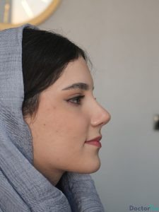 نمونه عمل بینی دکتر لیلا ملکی 1