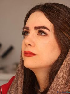 نمونه عمل بینی دکتر لیلا ملکی 3