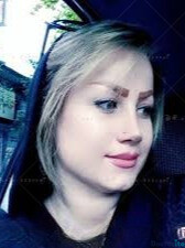 نمونه عمل بینی دکتر نوید رضوانی (6)