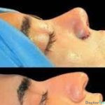 نمونه عمل دکتر ارشاد همتی (3)
