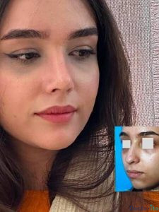 نمونه عمل دکتر رویا لطفی یگانه (2)