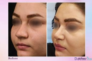 نمونه عمل دکتر سوسن سکوتی (7)