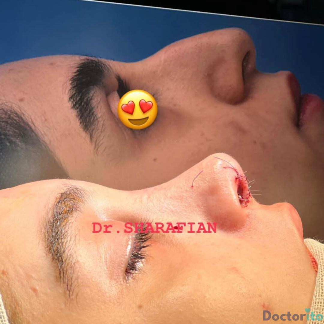 نمونه کار دکتر آرش شرفیان (1)